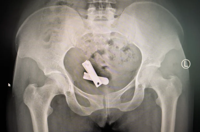 Baarmoeder onveilig in Tigray